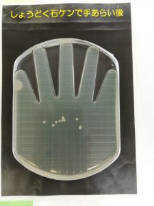 アルコール消毒後